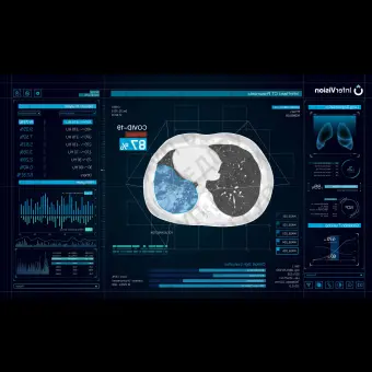 Медицинское программное обеспечение CT Pneumonia