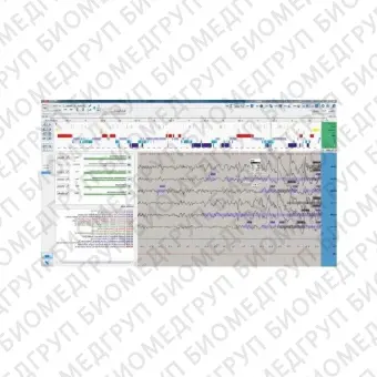 Модуль программного обеспечения для EMG EEGDigiTrack PSG