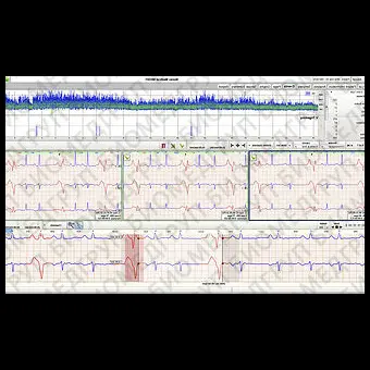 Программное обеспечение для холтеровского монитора NH301