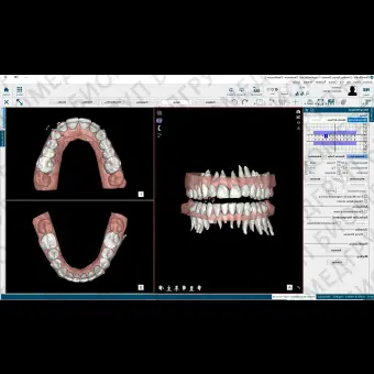 Программное обеспечение для обработки снимков зубов NemoCast