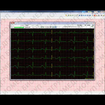 Программное обеспечение для электрокардиографии