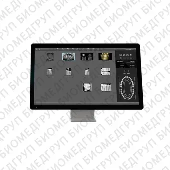 Программное обеспечение для обработки снимков зубов AIS  ACTEON Imaging Suite