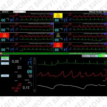 Тритон СЦМ2.17 Центральная мониторная станция