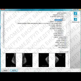 Медицинское программное обеспечение DICOMReader