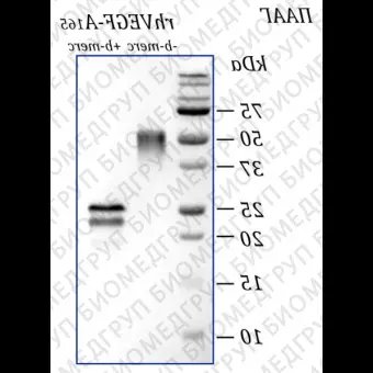 Фактор роста эндотелия сосудовА человека, изоформа 165, рекомбинантный белок, rhVEGFA165, Россия, PSG01010, 10 мкг