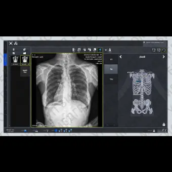 Программное обеспечение рентгенографии VXvue with PureImpact