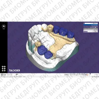 Exocad Partial Framework Module  модуль для создания бюгелей