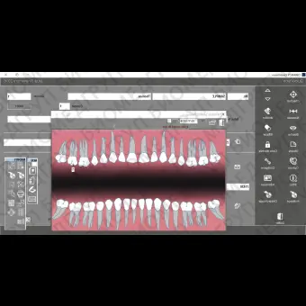 Программное обеспечение для обработки снимков зубов Quickvision