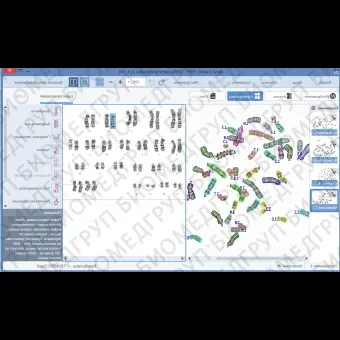 ПО для автоматического анализа хромосом, кариотипирования, АргусKaryo, АргусСофт, ARGUS  KARYO