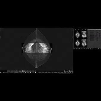 Информационная рабочая станция для маммографии MammoVU