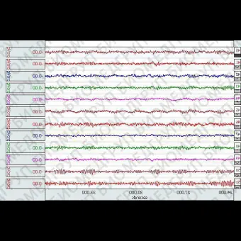 Амплификатор для ЭЭГ BNEEG2