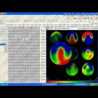 Неврологическое программное обеспечение EEG DigiTrack