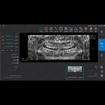 Программное обеспечение для обработки снимков зубов SmartV Pro
