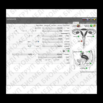 Программное обеспечение для гинекологического обследования NEXUS / OBSTETRICS