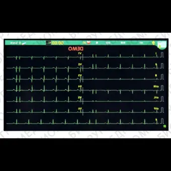 Электрокардиограф для спокойного состояния T12B