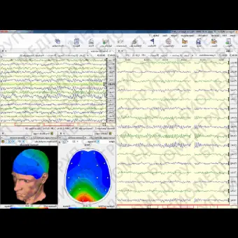 ЭЭГсистема 32 канала NEURONSPECTRUM5