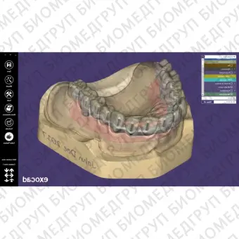 Exocad Bar Module  модуль для создания балочных конструкций