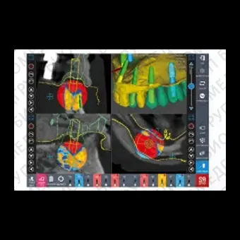 Программное обеспечение для стоматологической имплантологии R2GATE