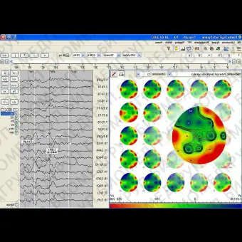 Неврологическое программное обеспечение EEG DigiTrack