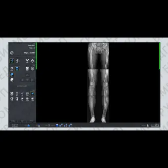 Программное обеспечение рентгенографии VXvue with PureImpact