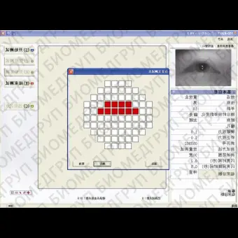 Офтальмологический периметр MD820A