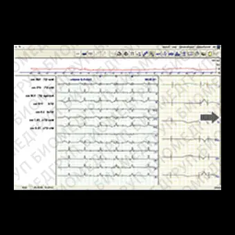 Кардиомонитор Холтера 12 каналов CARDICODE300H