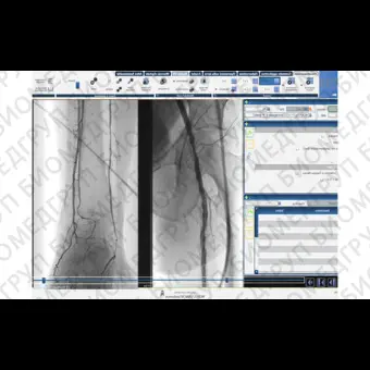 Программное обеспечение для ангиографии CAAS XA