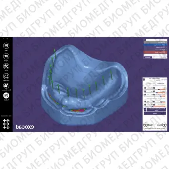 Exocad Full Denture Module  модуль для создания полносъемных протезов