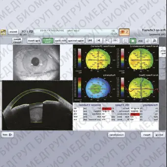 Офтальмоскоп ОКТ CASIA2