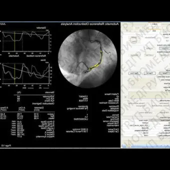 Программное обеспечение для ангиографии CAAS XA