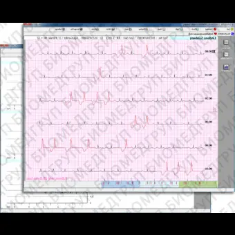 Программное обеспечение для электрокардиографии CVS03