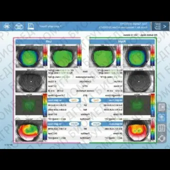 Роговичный топограф OPDScan III VS