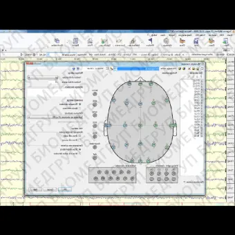 ЭЭГсистема 32 канала NEURONSPECTRUM5