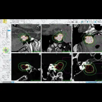 Медицинское программное обеспечение Leksell GammaPlan