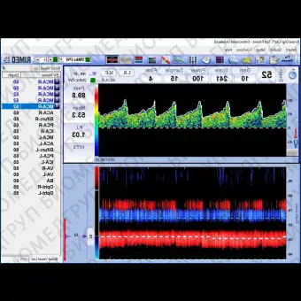 Трансчерепной доплер DigiOne