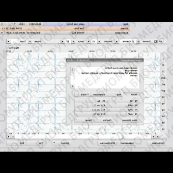 Медицинское программное обеспечение 94825