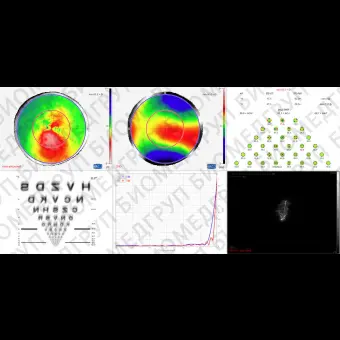 Роговичный топограф OSIRIST