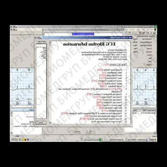 Ветеринарное программное обеспечение ECG Interpreter