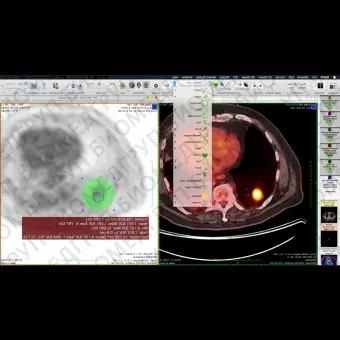 Программное обеспечение SPECT