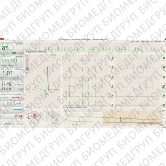 Кардиомонитор Холтера 12 каналов BTL CardioPointHolter H600