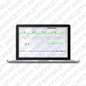 Программное обеспечение для лаборатории сна DOMINO