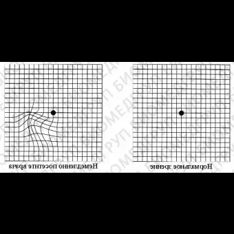 HDC9000 Проектор знаков для проверки зрения