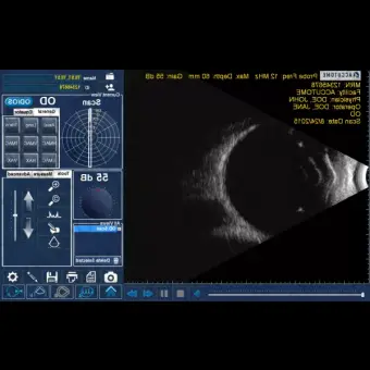 Bscan Plus Офтальмологический ультразвуковой Bсканер