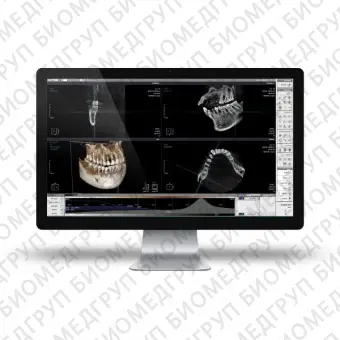Программное обеспечение для обработки снимков зубов XELIS