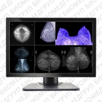 Double Black Imaging Image Systems Gemini Series 8MP Large Format Display Медицинский монитор