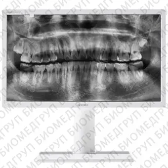 Barco Nio Color 2MP MDNC2123 Option DE Dental Медицинский монитор