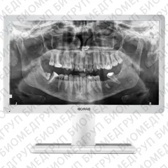 Barco Eonis 22 MDRC2222 Option WP Dental Медицинский монитор