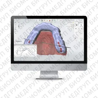 Ортодонтическое программное обеспечение SPLINT STUDIO