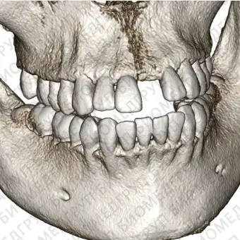 Программное обеспечение для стоматологии Invivo6