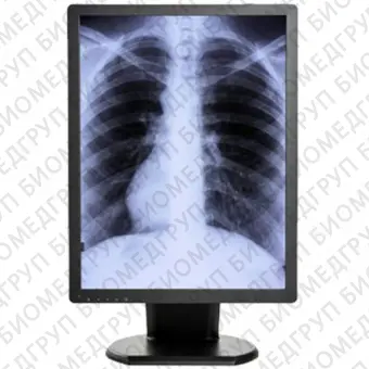 Double Black Imaging 3MP Monochrome Diagnostic Display Медицинский монитор